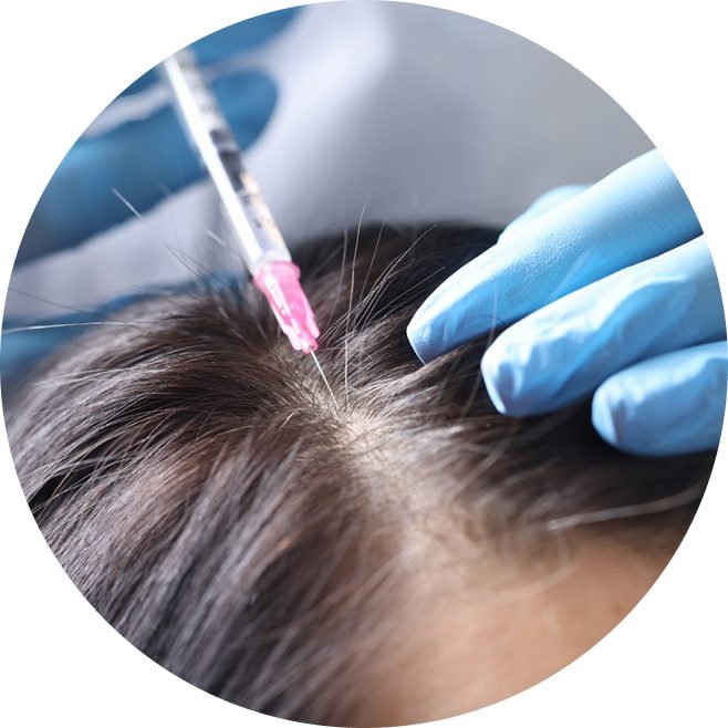 Ellipse 25 16 - NeoGraft Hair Clinic Chandigarh