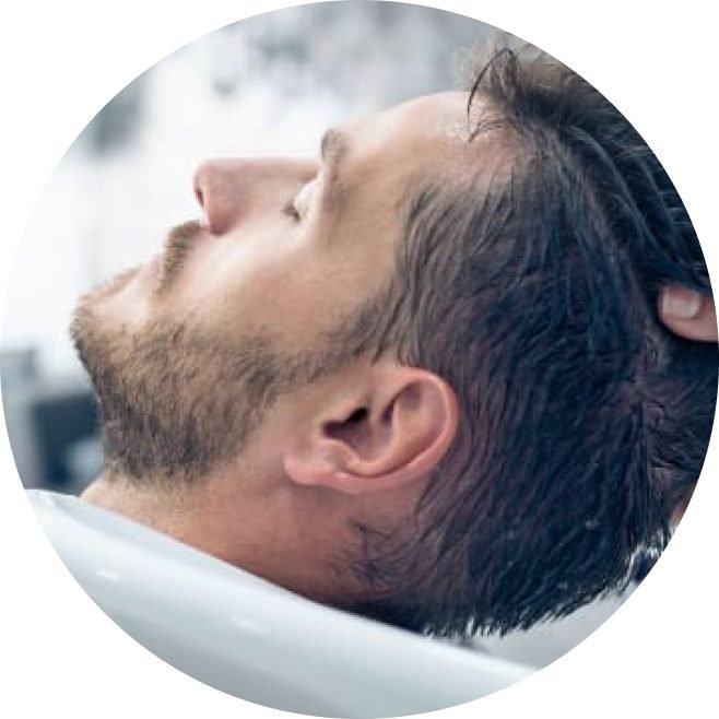Ellipse 25 4 - NeoGraft Hair Clinic Chandigarh