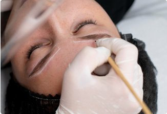 Eyebrow transplant in Chandigarh at NeoGraft Hair Clinic