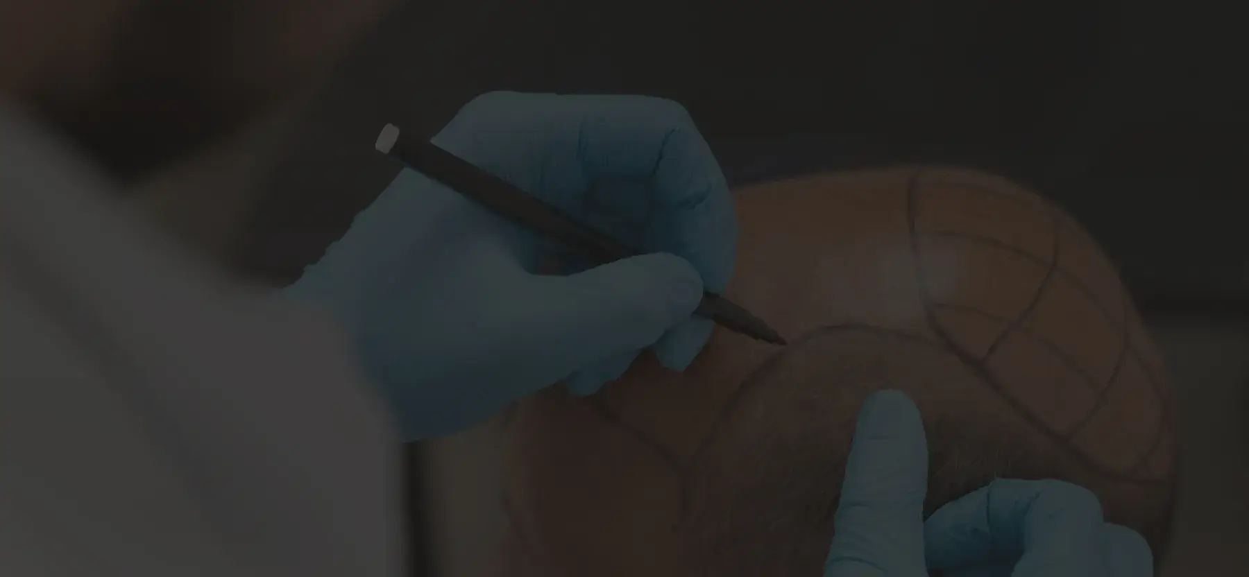 Banner image 1 - NeoGraft Hair Clinic Chandigarh