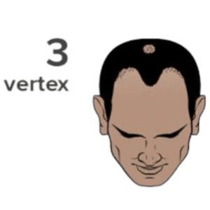Grade 3V