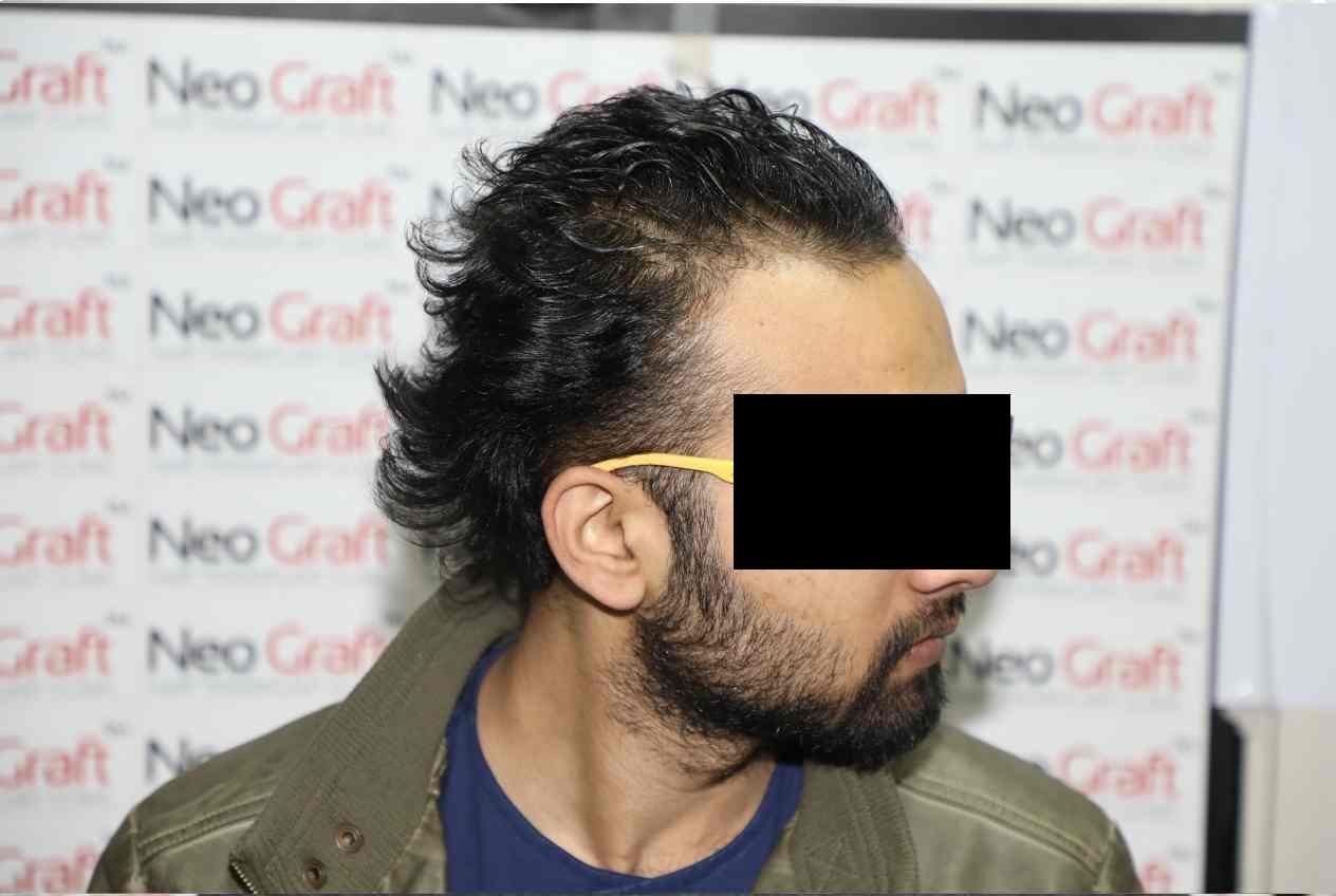Before