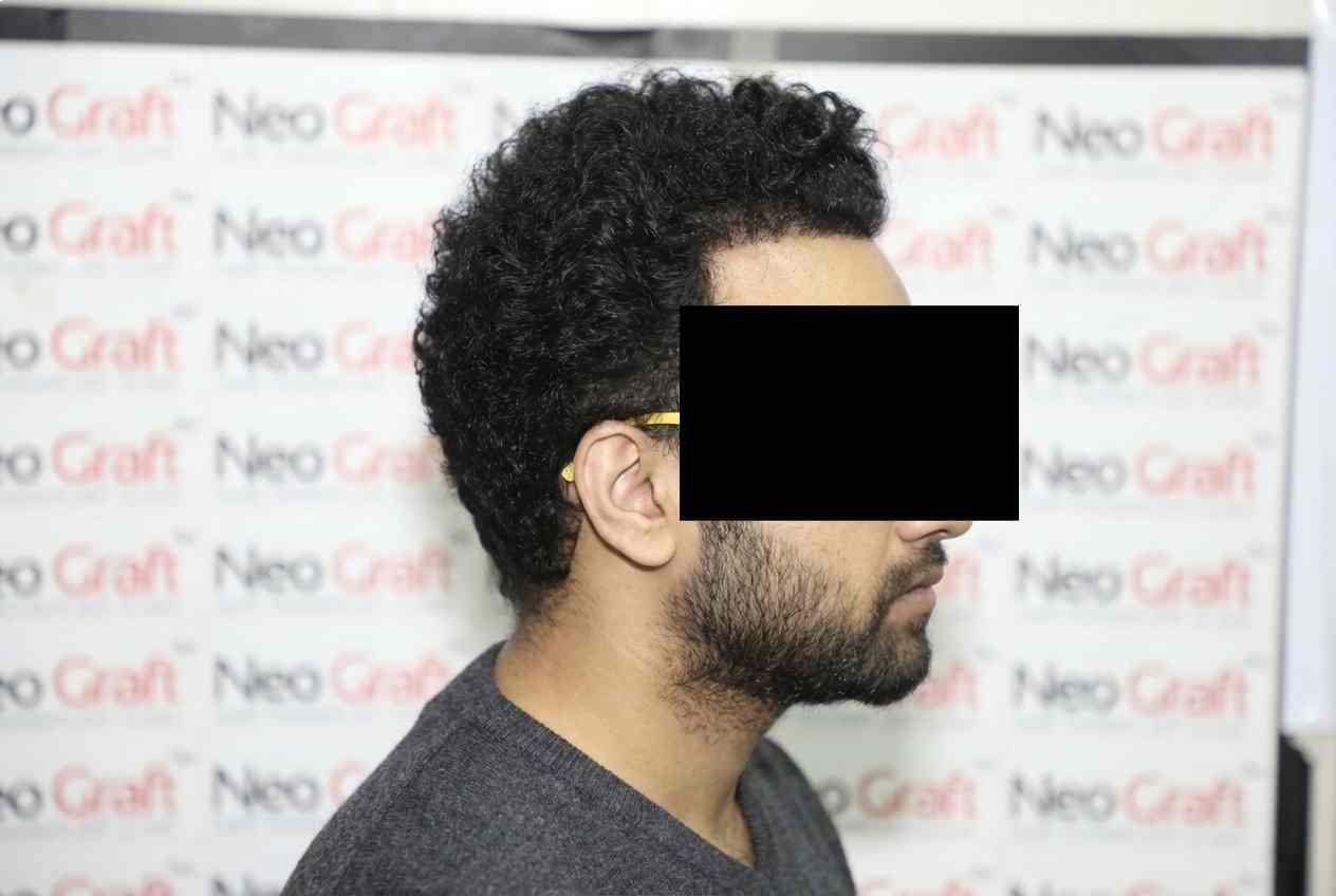 After