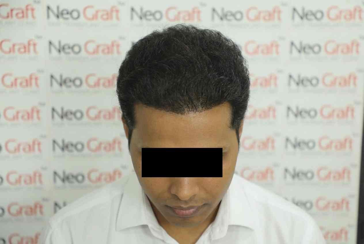 After